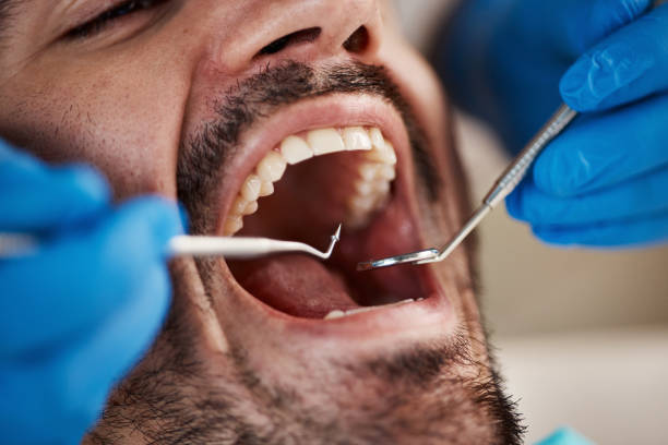 Best Emergency Cosmetic Dentistry in Seattle, WA